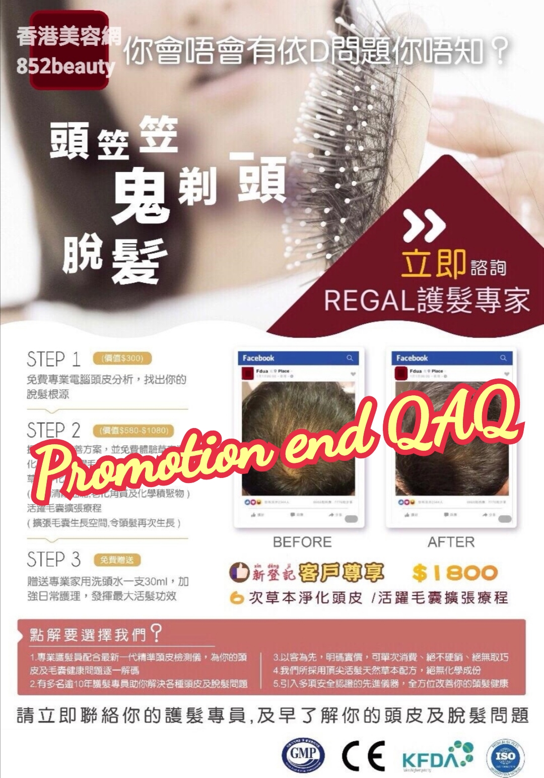 Hong Kong Beauty Salon Latest Beauty Discount: 美容優惠 - 尖沙咀區] 脫髮救星 ! 活髮有辦法 !!  (已結束)
